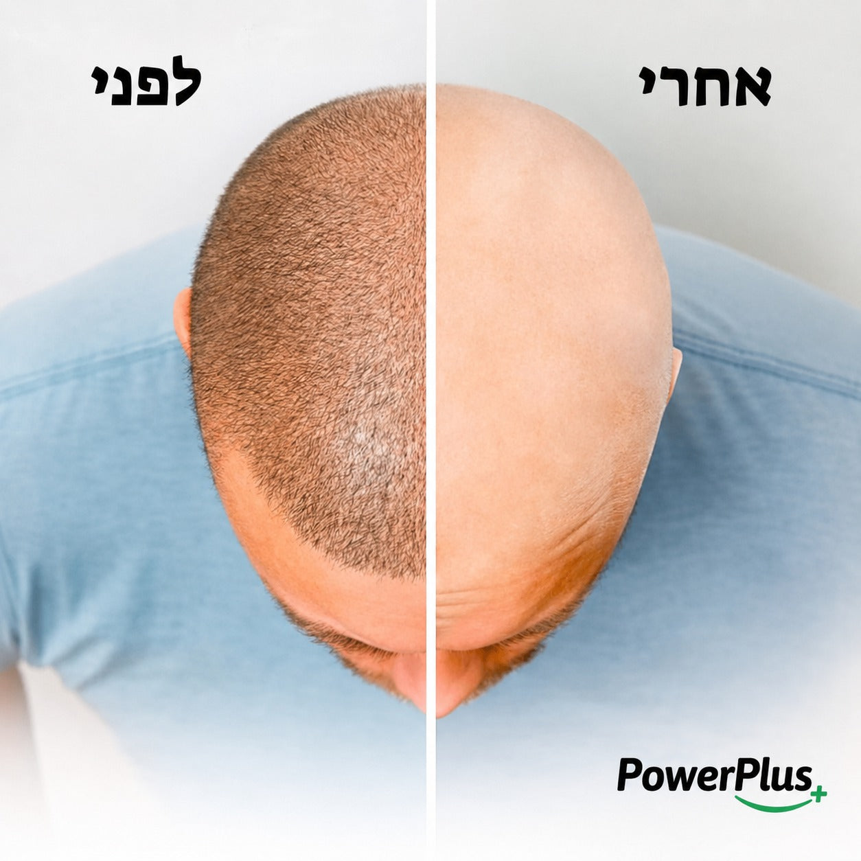 תוצאת Calvo